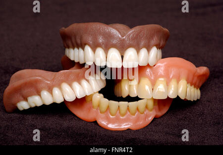 Due serie di protesi completa. Protesi o falsi denti sono realizzati a partire da una base in acrilico su cui acrilici o denti di ceramica sono montati. Foto Stock