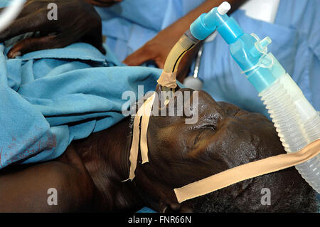 Un paziente sotto anestesia è equipaggiato con un tubo endotracheale a ventialte i suoi polmoni durante un'operazione. Foto Stock