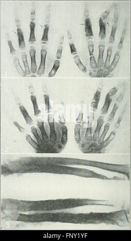 American journal of roentgenology, radium terapia e medicina nucleare (1906) Foto Stock