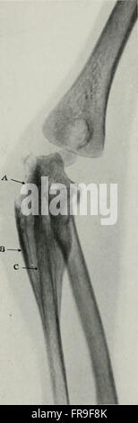 Vivere anatomia e patologia; la diagnosi delle malattie nei primi anni di vita mediante il metodo di Roentgen (1910)