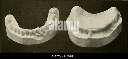 Generale e patologia dentale con particolare riferimento ad eziologia e anatomia patologica; un trattato per studenti e professionisti (1920) Foto Stock