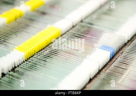 Rack di vetrini per microscopio in vetro contenente il paziente o la ricerca dei campioni di prova da un ospedale laboratorio di patologia. Foto Stock