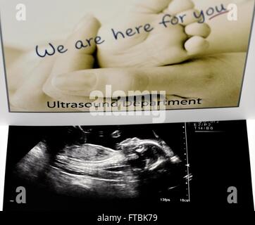 Un 2° trimestre baby boy di scansione ad ultrasuoni Foto Stock