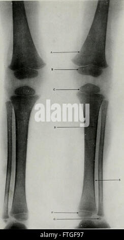 Vivere anatomia e patologia; la diagnosi delle malattie nei primi anni di vita mediante il metodo di Roentgen (1910)