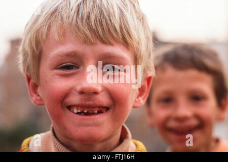 Un ragazzo giovane sorride, rivelando il suo denti cariati, Saranda, Albania. Foto Stock