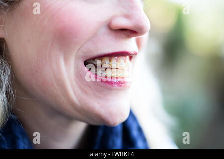 Signora con un tutore Foto Stock