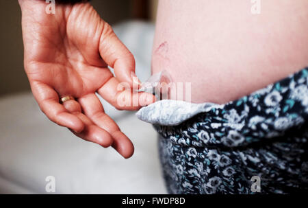 Donna di mezza età utilizzando Evorel Conti HRT patch per aiutare con la menopausa terapia ormonale sostitutiva Trattamento Foto Stock