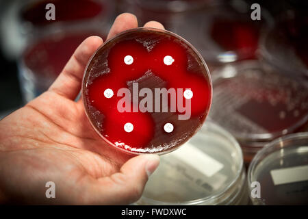 Piastre di sangue antibiotici test di campioni liquidi lab laboratorio prove di laboratorio prove di analisi del paziente analizzato il siero bl Foto Stock