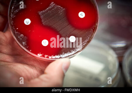 Piastre di sangue antibiotici test di campioni liquidi lab laboratorio prove di laboratorio prove di analisi del paziente analizzato il siero bl Foto Stock