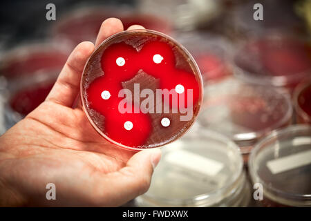 Piastre di sangue antibiotici test di campioni liquidi lab laboratorio prove di laboratorio prove di analisi del paziente analizzato il siero bl Foto Stock
