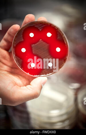 Piastre di sangue antibiotici test di campioni liquidi lab laboratorio prove di laboratorio prove di analisi del paziente analizzato il siero bl Foto Stock