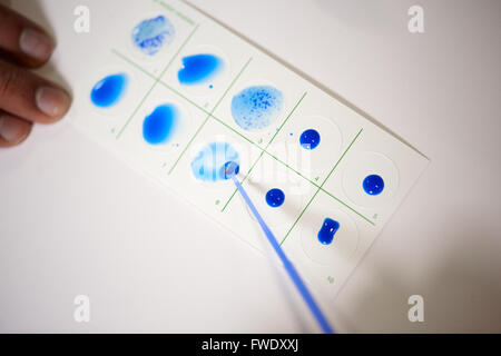 La febbre di test positivi risultati scheda mononucleosi blu test sono esami del sangue per la ricerca di anticorpi che indicano la mononucleosi Foto Stock