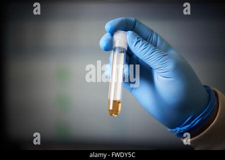 Provetta di test clinici di campione Foto Stock