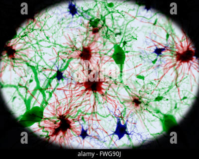 Le cellule cerebrali illustrazione di tre tipi di cellule cerebrali: astrociti (rosso) neuroni piramidali (verde) e cellule microgliali (blu) Foto Stock