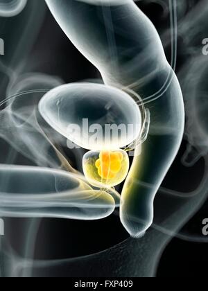 Cancro umano della prostata, illustrazione del computer. Foto Stock