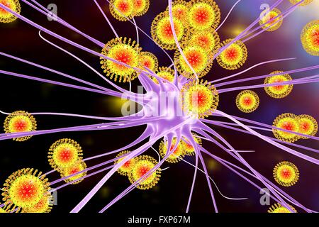 Zika virus di infettare i neuroni, illustrazione del computer. Questo è un RNA (acido ribonucleico) virus dalla famiglia Flaviviridae. Essa è trasmessa agli esseri umani attraverso il morso di un virus per Aedes sp. zanzara. Essa provoca febbre zika, una malattia lieve con sintomi inclusi rash, dolori articolari e congiuntivite. Il virus di Zika ha dimostrato di replicarsi in cellule nervose. Questo può portare a microcefalia (testina di piccole dimensioni) nei feti, che possono causare aborto spontaneo o morte subito dopo la nascita o portare a ritardi di sviluppo e disturbi. Nei bambini e negli adulti può portare alla sindrome di Guillain-Barre, che provoca Foto Stock