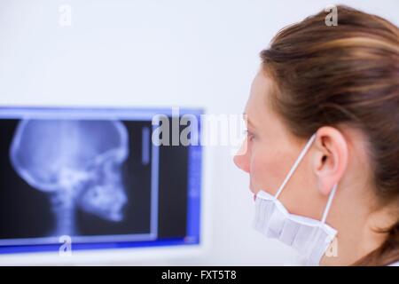 Vista laterale del dentista cerchi a raggi x immagine sullo schermo del computer Foto Stock