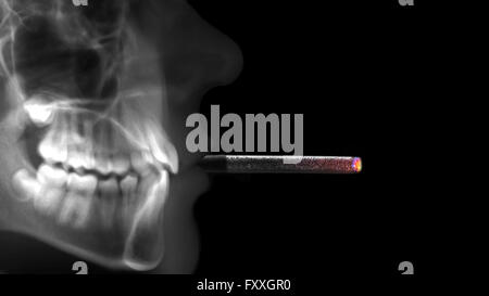 Human x-ray Sigaretta fumare Foto Stock