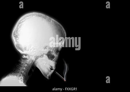 Human x-ray Sigaretta fumare Foto Stock