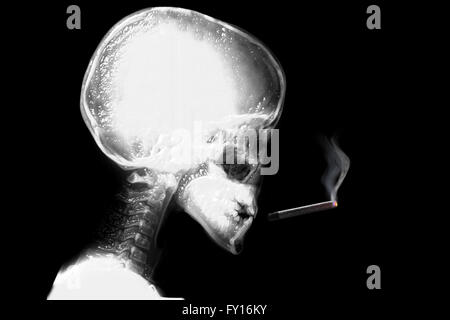 Human x-ray Sigaretta fumare Foto Stock
