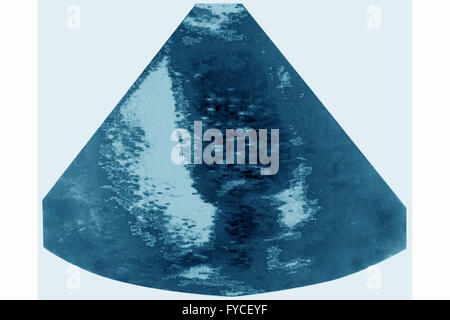 Ultrasuoni feto Foto Stock