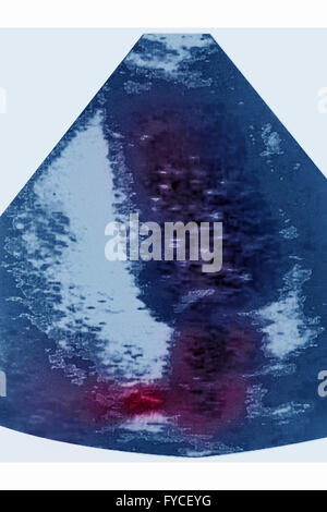 Ultrasuoni feto Foto Stock