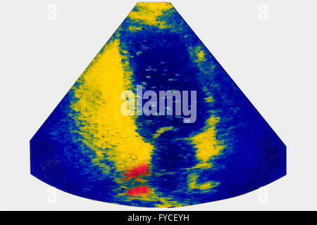 Ultrasuoni feto Foto Stock