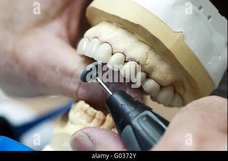 Loop di correzione del finito porcellanato cro Foto Stock