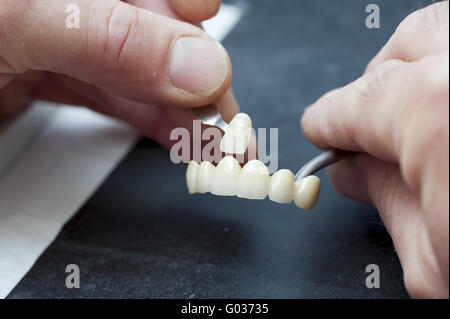 Confronto del colore del finito corone dentali Foto Stock