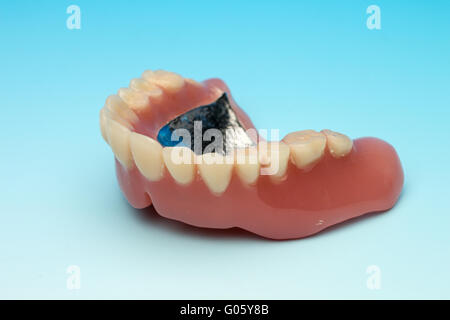 Dentiera con base in metallo Foto Stock