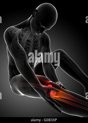 3d reso illustrazione di dolore al ginocchio Foto Stock