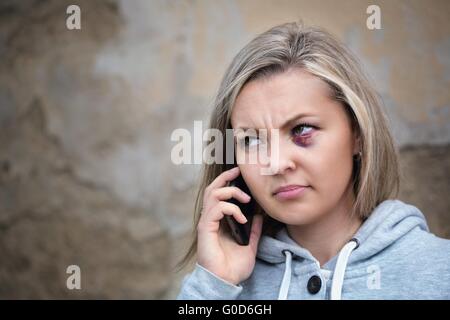 Spaventata donna con livido sulla faccia chiamare per ricevere assistenza Foto Stock