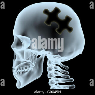 Raggi X di una testa con il pezzo del puzzle al posto del cervello, 3d illustrazione Foto Stock