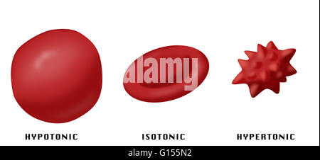 Illustrazione che mostra l'effetto di ipotonica, isotonica e soluzioni ipertoniche sulle cellule rosse del sangue. Foto Stock