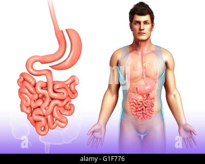 Manicotto gastrectomia (chirurgica perdita di peso chirurgia), illustrazione. Foto Stock