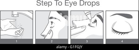 La fase di trattamento occhi con gocce per gli occhi Illustrazione Vettoriale
