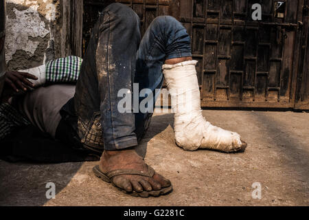 Uomo con cast sui suoi piedi e mani di dormire sul pavimento di Delhi, India. Foto Stock