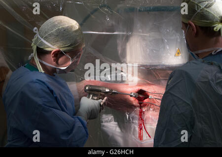 Chirurgo nel teatro lavorando su una decompressione di sinistra dell'anca il funzionamento della vite.Chiudere uo dell'operazione. Foto Stock