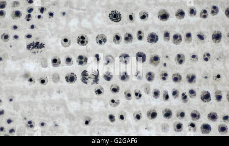 La mitosi divisione cellulare nella radice di cipolla punta, fotomicrografia in campo chiaro Foto Stock