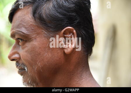 Il Nepal Adak (60), è scampato alla da La tigre di attacco da parte di fortuna, mostrando il suo pregiudizio segni sulla testa. Troppi in famiglia Sunderban hanno perso i loro familiari ai loro vicini di felino. Nella bagarre oltre il restringimento di habitat, le tigri sono attaccando gli uomini che entra nella foresta di cibo. Il riscaldamento globale ha portato ad un aumento in tiger uomo conflitto in Sunderban. A causa di un 45 cm aumento dell'acqua, i livelli di salinità in Sunderban hanno aumentato drasticamente. Ciò ha costretto la tigre a spostarsi verso nord (più densamente popolate del Sunderban risultante in un aumento in Tiger Foto Stock