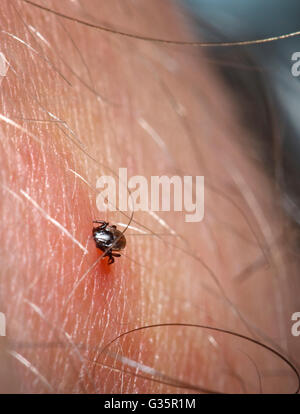 Un segno di spunta incorporato in un essere umano Foto Stock