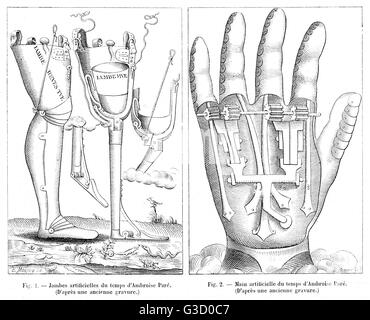 Illustrazione della gamba artificiale e la mano, dai tempi del barbiere chirurgo Ambroise Par&#x9828;c. 1510 1590) Data: XVI secolo Foto Stock