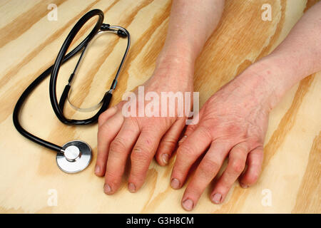 Artrite reumatoide le mani e lo stetoscopio su un tavolo di legno Foto Stock