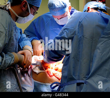 Una foto generica di un'operazione che ha luogo al Queen Elizabeth Hospital, Birmingham. Foto Stock