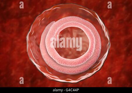 Cisti con Trichina spiralis nematode (in precedenza chiamato Trichinella spiralis), computer illustrazione. Questi parassiti possono infettare i mammiferi, compresi gli esseri umani, maiali, cani e ratti. Infezione segue il consumo di greggio o carne poco cotta che contiene le cisti della T. spiralis larve. Questi maturare nella forma degli adulti nell'intestino. Gli adulti vivono per circa 6-8 settimane, durante il quale tempo le femmine rilasciare un gran numero di larve che penetrano la parete dell'intestino. Da qui essi migrano intorno al corpo provocando febbre e dolori e la formazione di cisti nei muscoli. Foto Stock