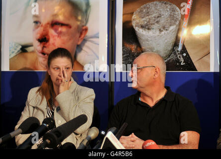 Michelle Manley si rivolge a una conferenza stampa presso la sede centrale della polizia di Essex per chiedere informazioni in un incidente sulla A12 dopo che un blocco di cemento è stato fatto cadere su una macchina guidata dal padre Steve, (a destra), ferendo gravemente sua madre, Carol. Foto Stock