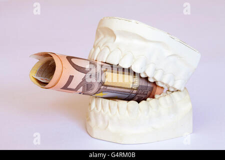 Calco in gesso di dentiere con banconote da 50 euro note, la mascella e la mandibola getta, immagine simbolica di costosi dental Foto Stock