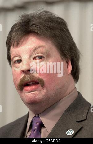 Simon Weston promuove la sua carità Foto Stock