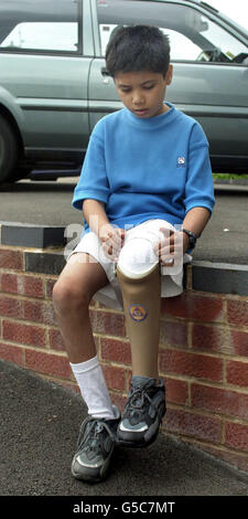 Parth Joshi, 11, la cui gamba è stata schiacciata nel terremoto indiano all'inizio di quest'anno, mette sulla sua nuova gamba artificiale a Tuffley, Gloucester, dopo che un ente di beneficenza locale 'Rapid UK' ha pagato per il suo volo e trattamento. Parth volò in Gran Bretagna per essere equipaggiato con la gamba protesica dopo che il suo arto era * mangled nel disastro, che ha causato la vita di almeno 20,000 persone in gennaio, tra cui sua madre e suo fratello. Parth stesso è stato salvato vivo dai detriti quando è stato tirato dal relitto dopo essere stato intrappolato per 84 ore. Foto Stock