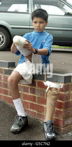 Parth Joshi, 11, la cui gamba è stata schiacciata nel terremoto indiano all'inizio di quest'anno, mette sulla sua nuova gamba artificiale a Tuffley, Gloucester, dopo che un ente di beneficenza locale 'Rapid UK' ha pagato per il suo volo e trattamento. Parth volò in Gran Bretagna per essere equipaggiato con la gamba protesica dopo che il suo arto era * mangled nel disastro, che ha causato la vita di almeno 20,000 persone in gennaio, tra cui sua madre e suo fratello. Parth stesso è stato salvato vivo dai detriti quando è stato tirato dal relitto dopo essere stato intrappolato per 84 ore. Foto Stock